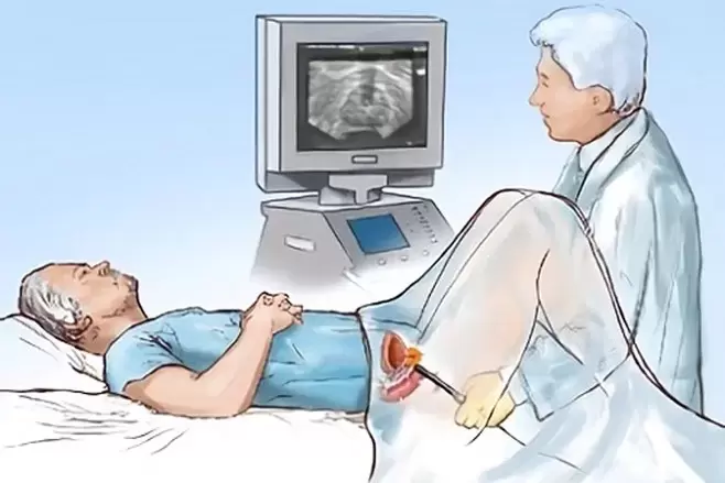 diagnose van prostatitis